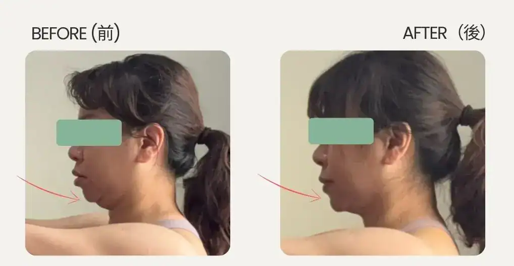 肽纖然