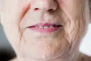 皺紋